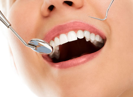 Teeth cleaning and tartar removal package at \