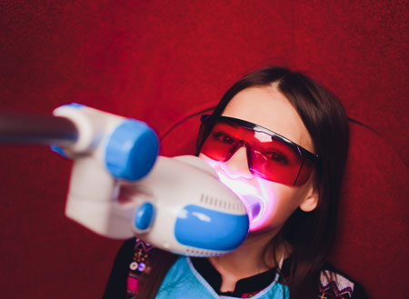 Laser teeth whitening and cleaning package for the jaws at \